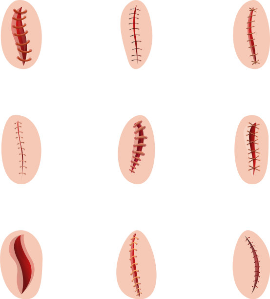 外科缝合图标集卡通风格图片下载