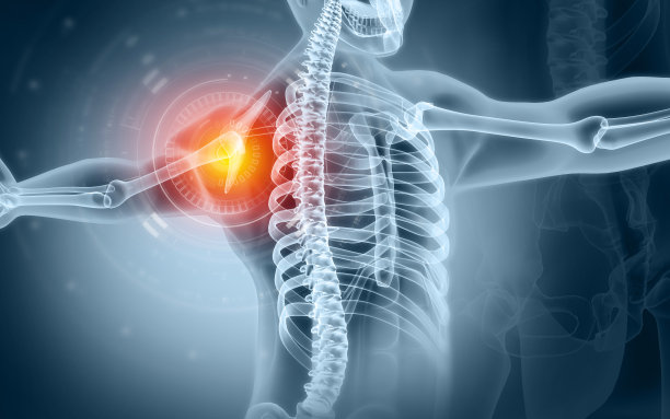 人肩关节疼痛，x光片，肩韧带肌腱炎，肩肌肉劳损。三维演示图片下载