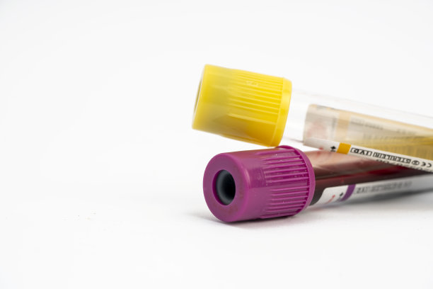 实验室检查和血液测试概念主题与两个试管隔离在白色背景与copyspace股票照片图片下载