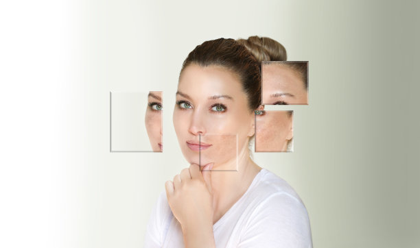 黑斑，雀斑，色素沉着(黄褐斑或黄褐斑)，概念-皮肤白化，皮肤白化，果酸，AHA，皮肤白化图片下载