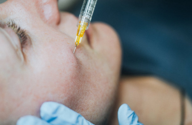 一个女人在面部PRP治疗的特写图片下载