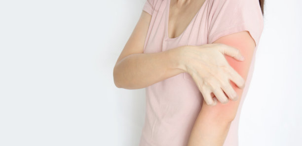 女人都是瘙痒和抓痒的皮肤病。医疗保健和医学的概念。图片下载