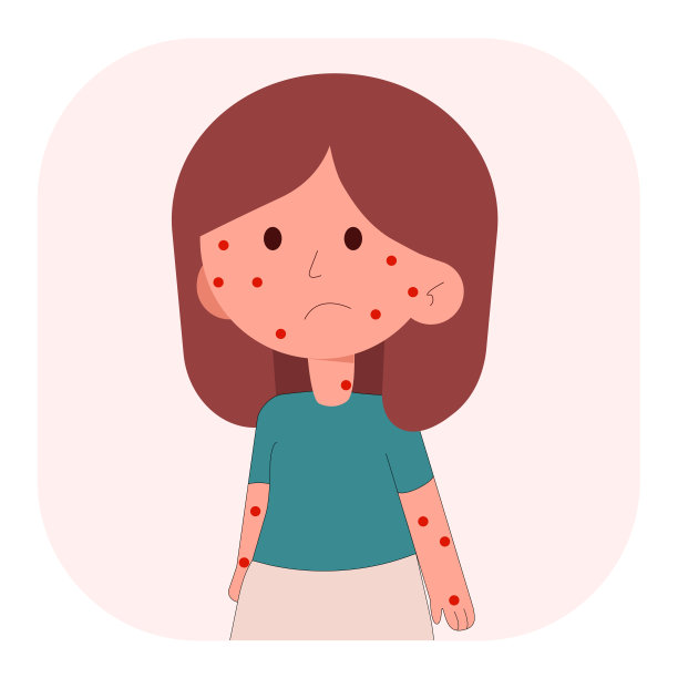 小女孩宝宝生病的孩子脸水痘病毒信息图图标设计。矢量平面字符插图。观察有天花、水痘症状的儿童。图片下载