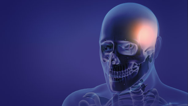 剧烈的头痛图片下载