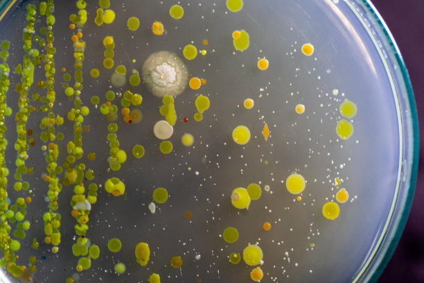 微生物实验室培养土壤样品琼脂平板上生长的细菌和霉菌的特性和不同形状菌落的背景。图片下载