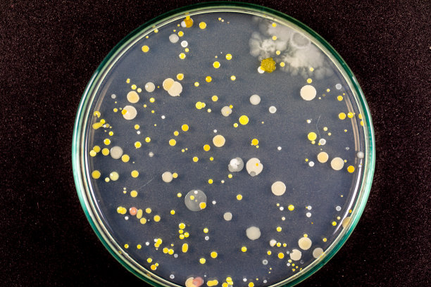 微生物实验室培养土壤样品琼脂平板上生长的细菌和霉菌的特性和不同形状菌落的背景。图片下载