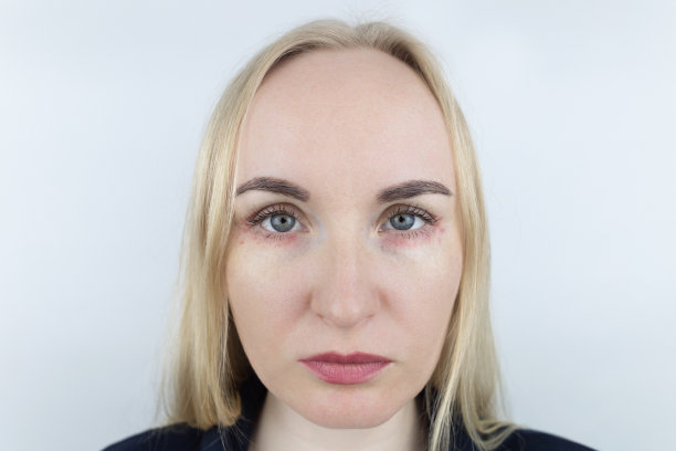 对化妆品过敏。女孩看着因使用有毒化妆品而出现的眼睛周围的痘痘。女性皮肤上有红斑图片下载