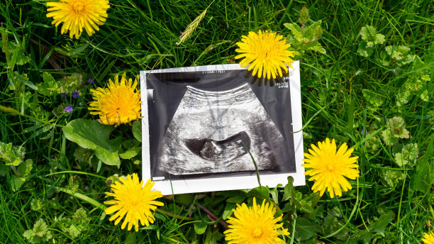 超声波照片怀孕婴儿。超声波怀孕图片在草花的背景。概念产妇，怀孕，分娩。图片下载