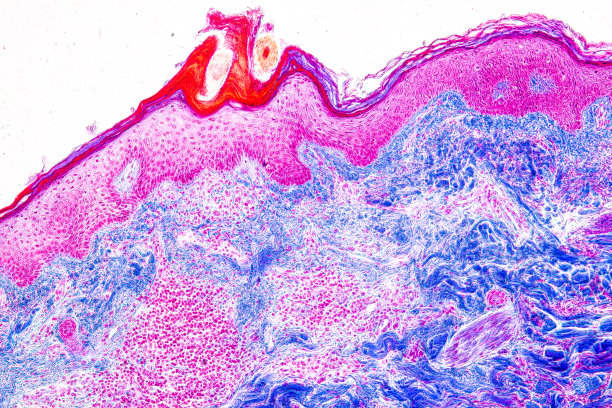 显微镜下的头皮和毛囊图片下载