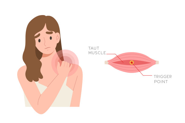 有颈部和肩部疼痛的年轻女性，并有肌肉触发点引起疼痛的信息图。图片下载
