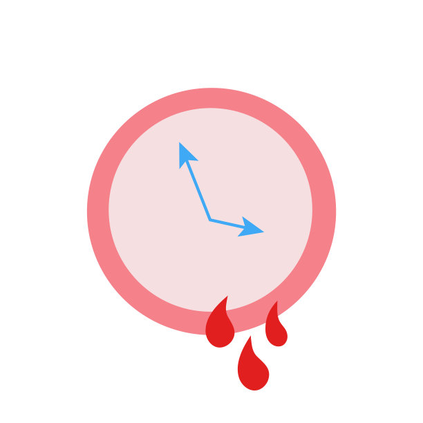 子宫息肉图片下载