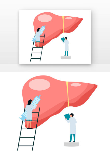 肝炎日医生检查世界肝炎日研究检查肝部图片下载