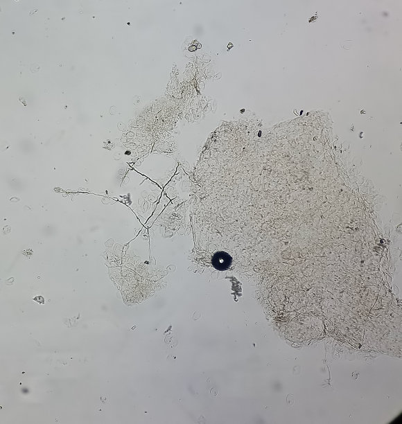 皮肤真菌菌丝显微图。真菌测试。皮肤刮痧，真菌感染的诊断。图片下载