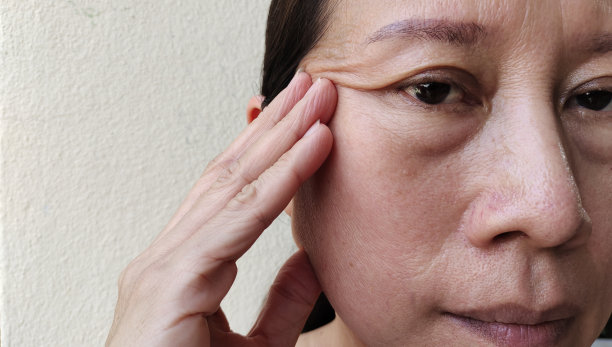 脸上的皱纹和松弛的皮肤。图片下载