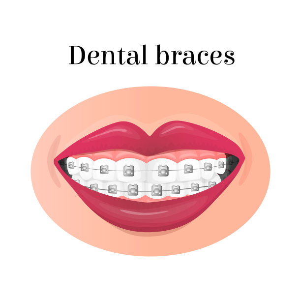 一个带着金属牙套的微笑的嘴的图像图片下载