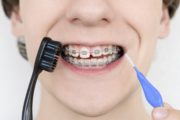 一个戴牙套的青少年拿着牙刷的特写图片下载