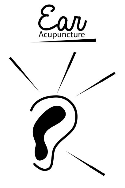 简单征针灸孤立于白上图片下载