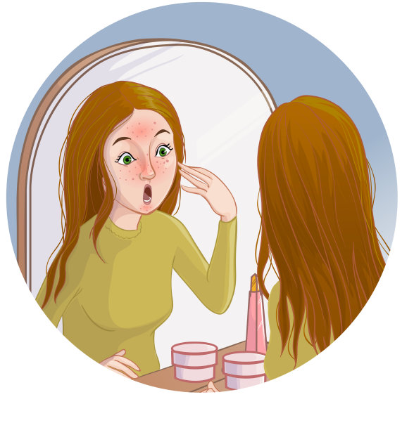 女人照镜子，看到皮肤上有红斑图片下载