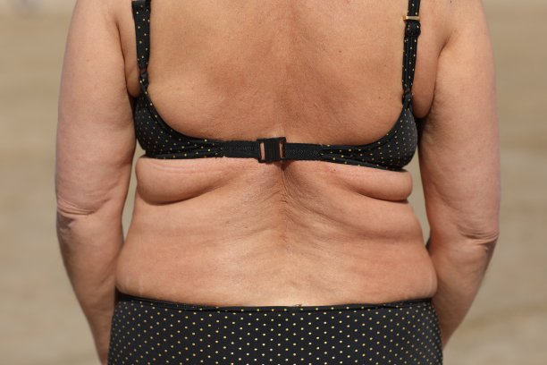 超重的肥胖女性，背部，腰部松弛，背部有脂肪褶皱，由于不适当的饮食导致超重的脂肪体。高质量的照片图片下载