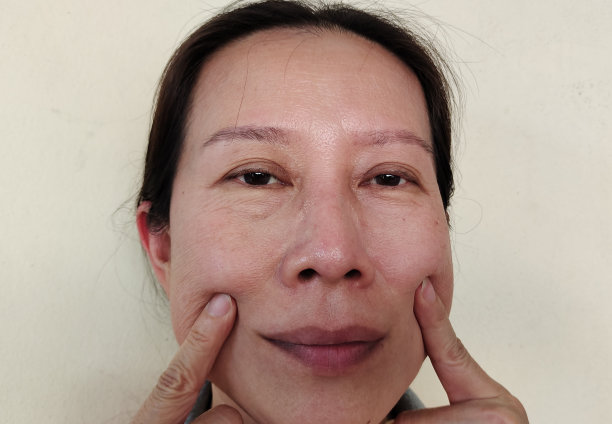 面部脂肪皮肤松弛，皱纹松弛。图片下载