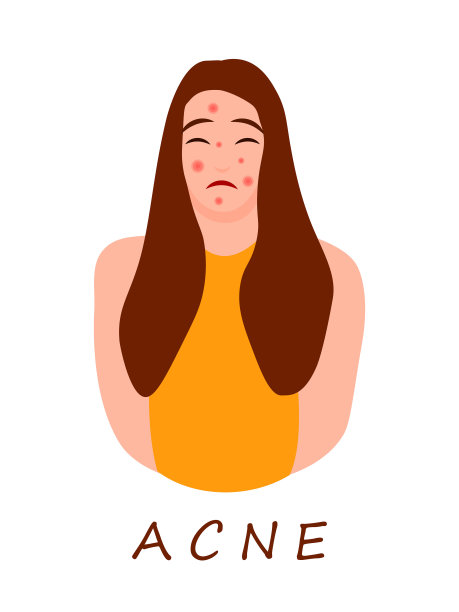痤疮皮肤的卡通少年人物。皮肤问题的概念。年轻的女孩在沮丧的情绪彩色矢量插图孤立在白色背景。医药美容保健图片下载