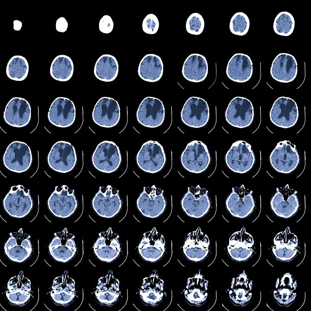 对大脑进行核磁共振扫描。磁共振成像扫描。医学、科学、教育CT背景图片下载