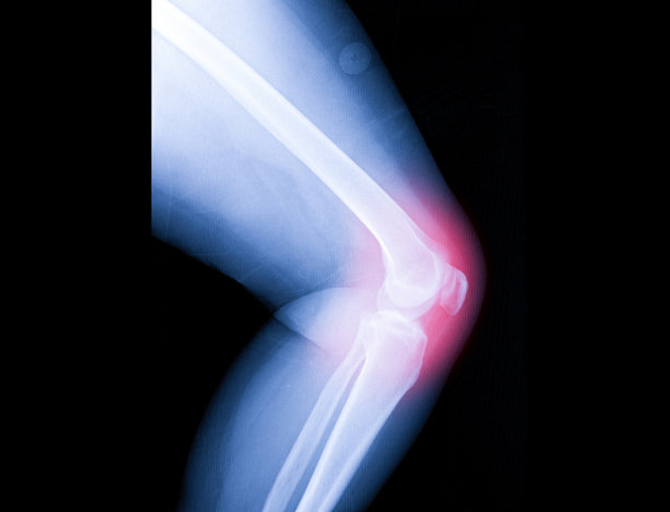 双膝x线片，人体膝关节图片下载