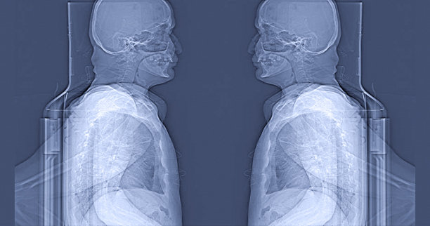 人脑CT扫描。医学、科教核磁共振脑背景。磁共振成像图片下载