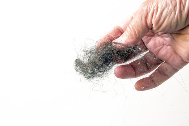 不健康的头发会脱落。图片下载