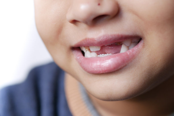 带着畸形牙齿微笑的小女孩图片下载