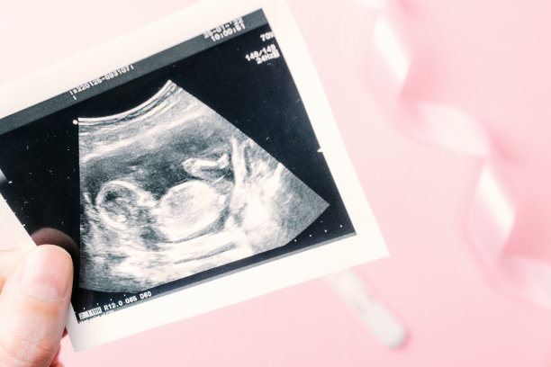 超声波拍孕婴照片。女性手握超声波怀孕图像的粉红色背景。怀孕的概念，母性，对婴儿的期望。图片下载