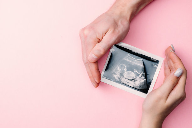 超声波拍孕婴照片。女性手握超声波怀孕图像的粉红色背景。怀孕的概念，母性，对婴儿的期望。图片下载