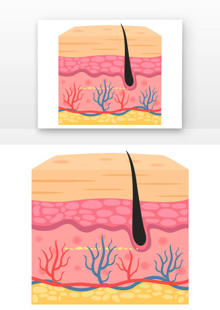 美容皮肤皮下组织图片下载