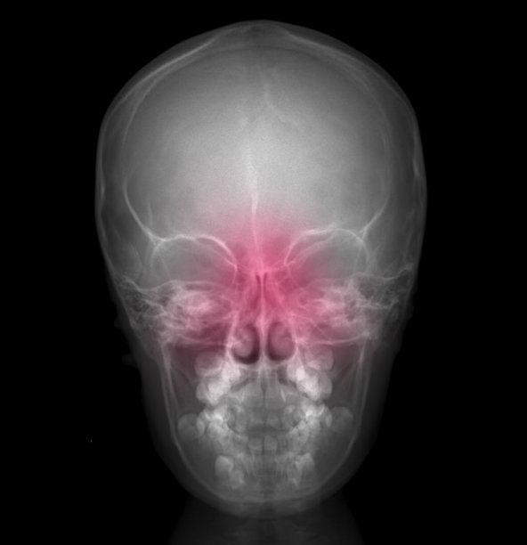 人类头骨x光图片下载