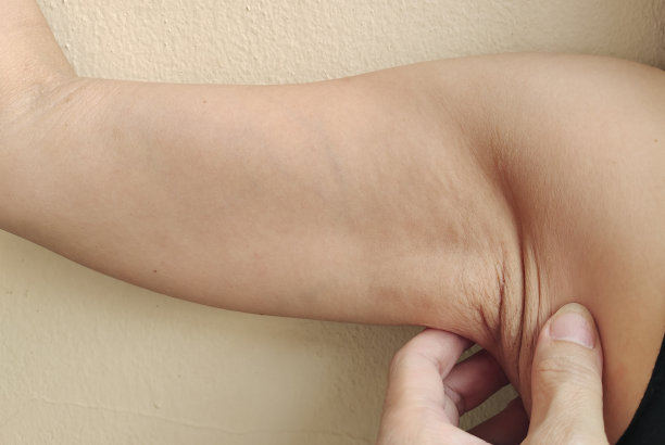 这张照片显示了女性手臂下下垂的脂肪、腋下的脂肪团和松弛的皮肤、腋毛和鸡皮。图片下载