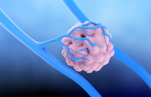 肿瘤细胞对血管生成的刺激图片下载