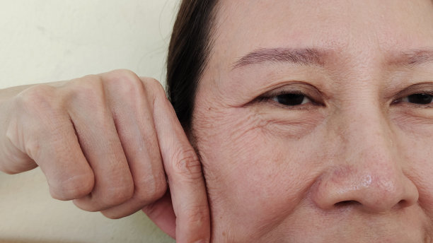 挤压脸部旁边的松弛脂肪挂皮、皱纹、眼下松弛皮肤。图片下载