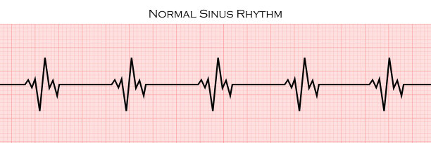 医学和心脏病学的概念。中性背景的心电图。检查脉搏、心跳和心率。图片下载