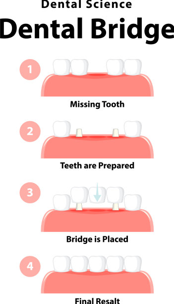 人在牙桥的信息图图片下载