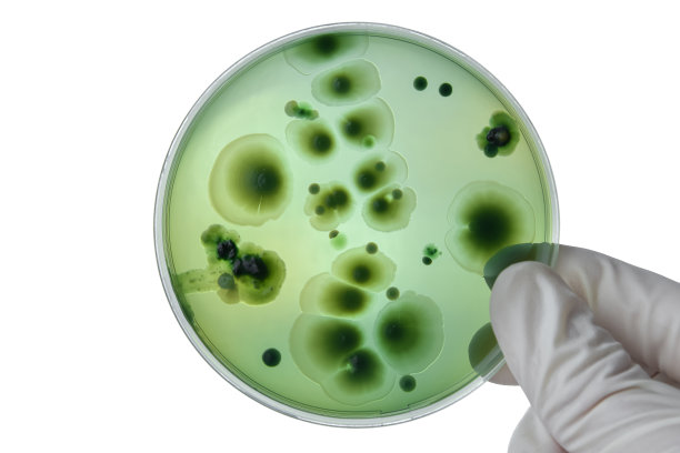 手拿有皮氏培养皿或带有白色背景细菌的培养基进行剪接，检测各种细菌、病毒、冠状病毒、COVID-19，微生物种群计数，食品科学。图片下载