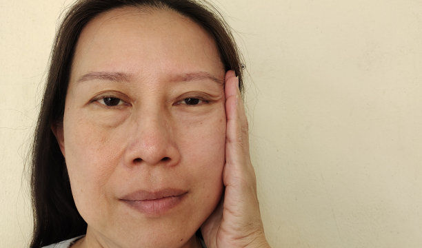 脸上的皱纹和斑点。图片下载