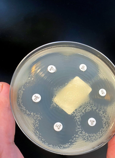 大肠杆菌与肺炎克雷伯菌混合培养。图片下载