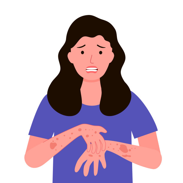 年轻女子抓挠手和胳膊。女性在平纹设计中患有强烈的过敏皮肤瘙痒症状。皮肤红疹刺激。图片下载