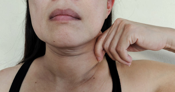 脖子下面松弛的脂肪皮肤、皱纹和下巴下面的脂肪团。图片下载