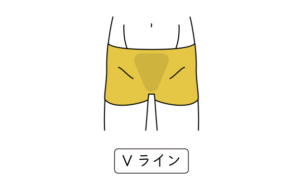 男士脱毛，v字，配内衣图片下载