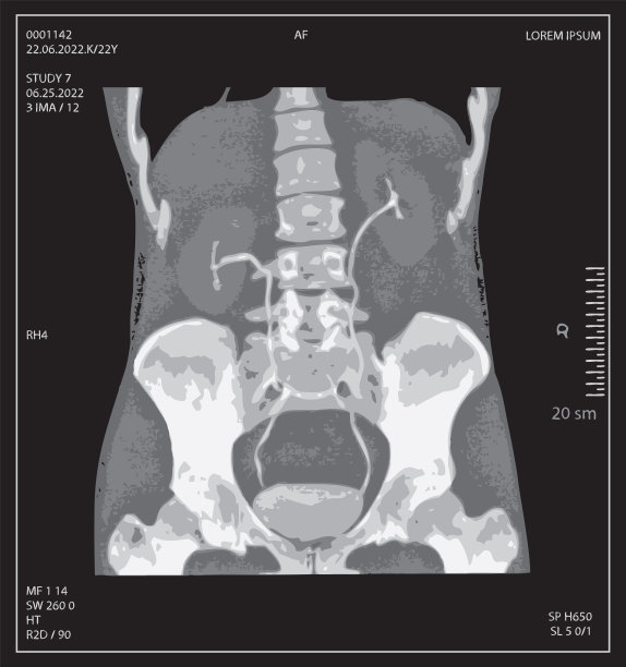 人体腹部、骨盆、脊柱x线片图片下载