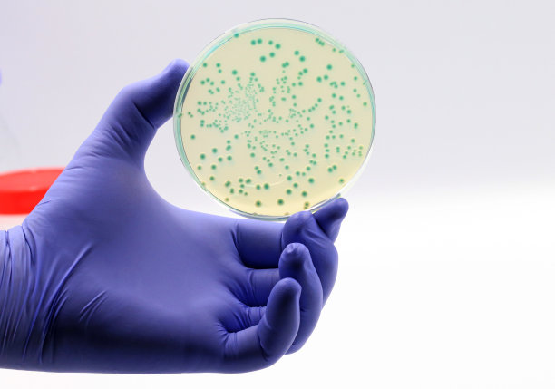 科学家或医生的手戴着蓝色手套，拿着一个有大肠杆菌选择性培养的培养皿图片下载