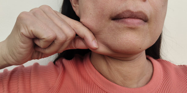 脸颊旁松弛的脂肪皮肤图片下载