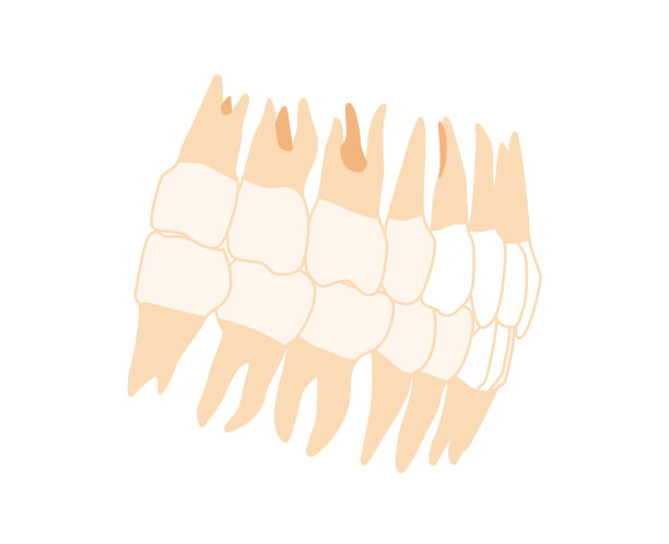 人牙义齿设置近人侧侧图片下载
