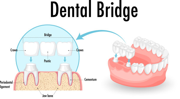 人在白牙桥上的信息图图片下载